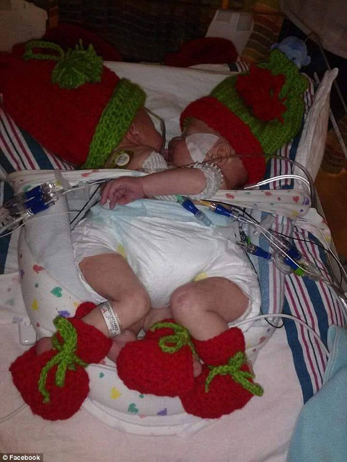 Cặp song sinh Carter và Conner Mirabal.