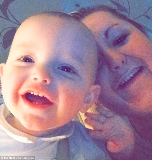 Kinh hai bong toan than vi dot soi chi thua tren vay-Hinh-6