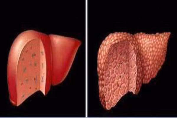 Gan. Bắt đầu lão hóa ở 70. Đây là bộ phận gần như không chịu khuất phục tuổi tác. Người ta có thể ghép gan của một ông già 70 tuổi cho một người 20 tuổi.