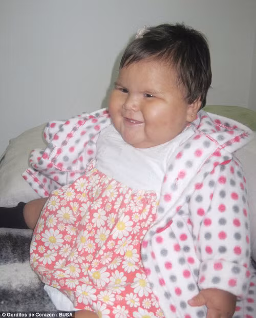 Mẹ của Juanita, Sandra Franco, vô cùng lo lắng khi thấy con gái tăng cân quá nhanh như vậy. Cô cho biết: “Khi được 15 ngày tuổi, Juanita rất mũm mĩm. Tôi đã rất vui vì lúc sinh Juanita khá nhỏ.