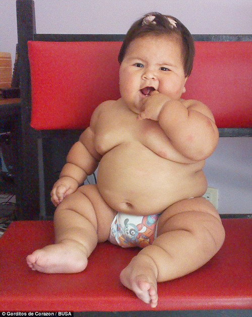 Lúc sinh ra, Juanita Valentina Hernandez chỉ nặng chưa đầy 3kg, nhưng chỉ sau tuần, em đã tăng cân nhanh chóng. Hiện tại, em đã ở mức 20kg dù mới chỉ 10 tháng tuổi.