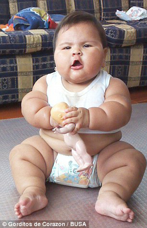 Ngoài ra còn các hội chứng khác như Cushings, hội chứng này do các hooc môn gây tăng cân, hội chứng Beckwith-Wiedemann cũng khiến trẻ tăng cân một cách bất thường.