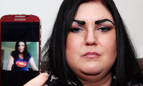  Cô nói: “Tôi vô cùng đau khổ và tuyệt vọng. Tôi đang cố gắng để di chuyển. Sáu tháng qua như là địa ngục với tôi vậy. Khi tôi ra phố, nhiều người lầm tưởng cho rằng tôi ăn quá nhiều nên thành ra béo vậy. Nhưng thực sự cơ thể tôi giống như cái nệm nước, người tôi chỉ toàn chất lỏng”.