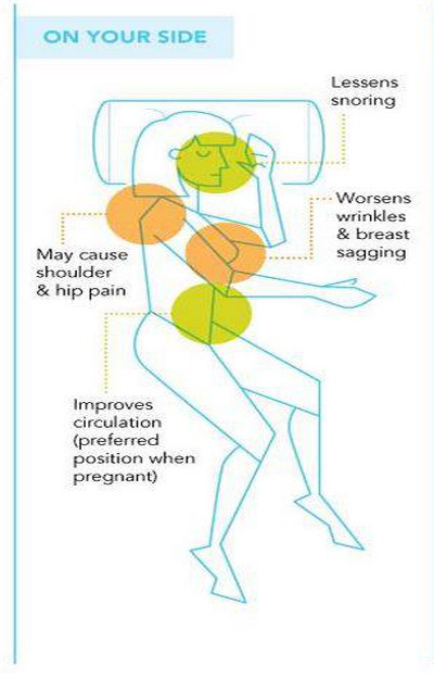 Tư thế thứ hai là nằm nghiêng một bên. Tư thế này sẽ khiến bạn đỡ ngáy tuy nhiên có thể làm cho vai và hông của bạn đau nhức do trọng lượng cơ thể tập trung vào một bên. Hơn nữa, vòng 1 của bạn theo tư thế này cũng sẽ bị xộc xệch đi trông thấy.
