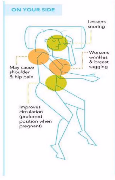 Tư thế thứ hai là nằm nghiêng một bên. Tư thế này sẽ khiến bạn đỡ ngáy tuy nhiên có thể làm cho vai và hông của bạn đau nhức do trọng lượng cơ thể tập trung vào một bên. Hơn nữa, vòng 1 của bạn theo tư thế này cũng sẽ bị xộc xệch đi trông thấy.