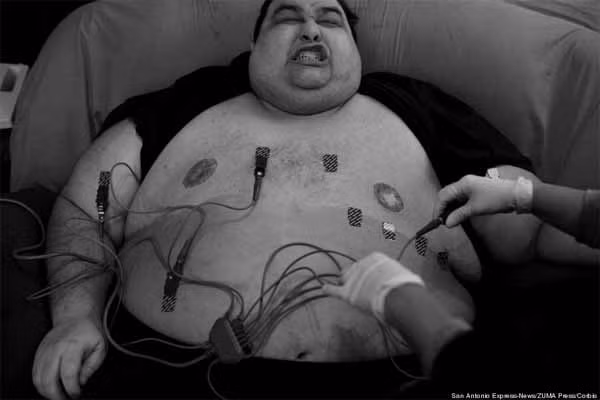 Ảnh chụp ngày 11/1/2011. Garcia nhăn mặt trong bài kiểm tra điện tâm đồ.