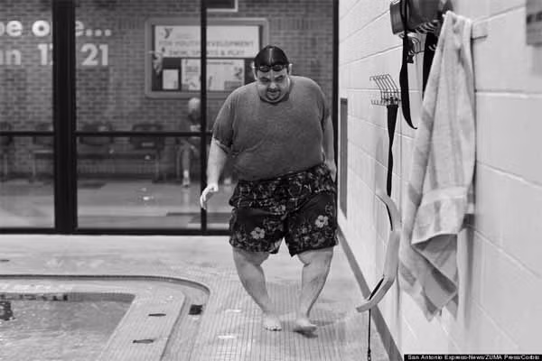 Năm 2000, anh Hector phải trải qua phẫu thuật dạ dày. Sau ca mổ này, anh đã giảm được gần 182 kg, song cân nặng trở lại như cũ. Năm 2012, Hector phẫu thuật thay thế cả hai đầu gối do nó bị trọng lượng trên thân đè nặng và bị hư hại. Trải qua các cuộc phẫu thuật, anh giảm được gần 159kg. Sau khi giảm 136kg, Garcia không còn cần khung để đi lại, nhưng những cơn đau từ đầu gối vẫn hành hạ. Ảnh chụp anh khó khăn bước quanh hồ bơi 20/4/2012.