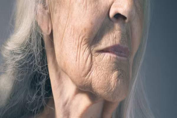  Nếp nhăn ở tai. Nếu dái tai của bạn có nếp nhăn chéo, đặc biệt là nếp gấp góc trong tai chia theo đường chéo từ lỗ tai xuống mép dưới của dái tai thì có thể bạn có liên quan đến bệnh động mạch vành. Lý thuyết đặt ra cho điều này là cơ tim và thùy tai được cung cấp bởi cùng một gốc di truyền và do đó nó chung một đường đi cuối cùng. 