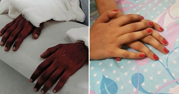 Cay ghep tay cua mot nguoi dan ong, co gai giat minh khi ban tay ngay mot nu tinh