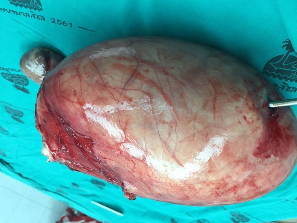 Benh nhan sung dau bung lau ngay khien bac si ta hoa vi dieu khung khiep