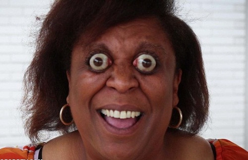 Sau tai nan, nguoi phu nu mac benh cuc di, tuy y dieu khien nhan cau-Hinh-3