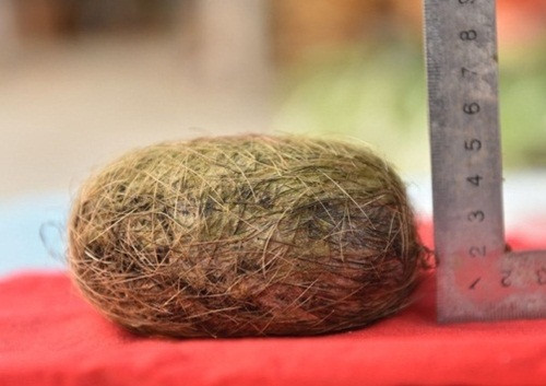 Tuong vo duoc “kho bau” trong bung lon dang gia ca tram trieu, ai ngo-Hinh-2