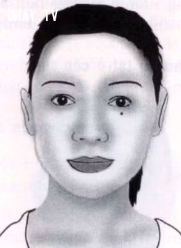 4. Nốt ruồi ở Lệ đường: Biểu thị chủ nhân là người đa tình, đa sầu đa cảm, dễ nảy sinh tình cảm nam nữ rắc rối, ngoại tình...