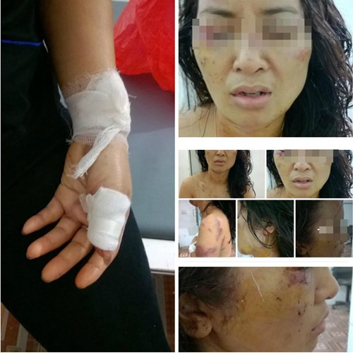 Chị O. bị đánh đập dã man khiến dư luận rúng động.