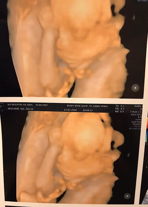 Siêu mẫu Hà Anh khoe ảnh siêu âm em bé trong bụng đã được hơn 5 tháng.