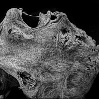 Cấu trúc xương của nó rõ ràng mang các đặc điểm của bộ xương con người với những đốt xương sống, khung sườn, xương cánh tay, xương chân… Chỉ có điều tất cả đều nhỏ bé hơn rất nhiều so với kích thước của một người bình thường.Một số nhà nhân chủng học ban đầu kết luận rằng hài cốt là của một đứa trẻ sơ sinh, có thể là sinh non hoặc tử vong ngay sau khi chào đời.