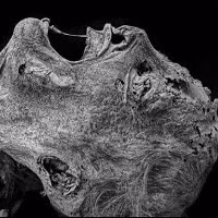 Cấu trúc xương của nó rõ ràng mang các đặc điểm của bộ xương con người với những đốt xương sống, khung sườn, xương cánh tay, xương chân… Chỉ có điều tất cả đều nhỏ bé hơn rất nhiều so với kích thước của một người bình thường.Một số nhà nhân chủng học ban đầu kết luận rằng hài cốt là của một đứa trẻ sơ sinh, có thể là sinh non hoặc tử vong ngay sau khi chào đời.