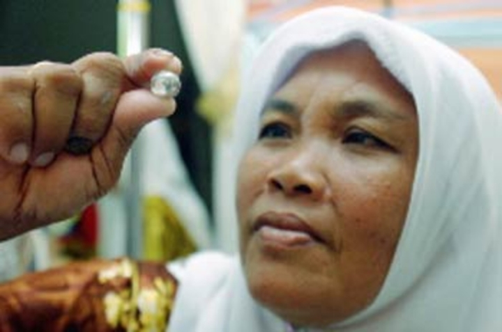 Mỗi lứa “đẻ” của ngón chân thường là 4 - 5 hạt, một số viên tròn xoe như hòn bi, số khác có màu xanh, trong suốt như ngọc. Nhả đá xong, miếng nứt trên ngón chân cô lại khép nguyên vẹn như cũ.