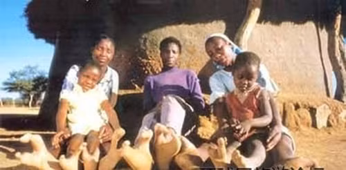  3. Tộc người bàn chân chỉ có hai ngón: Được gọi là "bộ tộc tôm hùm", những người có bàn chân hai ngón này sống khép kín trong thung lũng yên bình tại Botswana, chỉ cách biên giới Zimbabwe chừng 2 km.