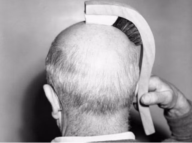 9. Lược chải tóc dành cho người hói.