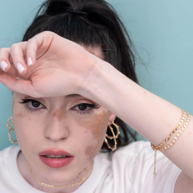 Trước khi trở thành mẫu ảnh, Stephanie là kỹ thuật viên chụp X-quang. Hiện tại, cô vừa duy trì công việc chuyên môn, vừa phát triển công việc của một influencer trên mạng xã hội.