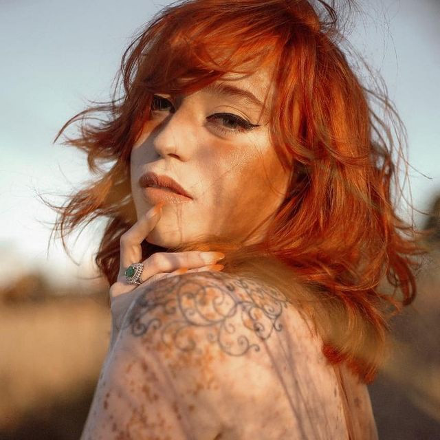 Stephanie bắt đầu đăng ảnh lên mạng xã hội để lan tỏa năng lượng tích cực đến những bệnh nhân mắc chứng bạch biến giống mình. "Hôm nay tôi thấy hạnh phúc, bình yên, tôi cảm thấy mình xinh đẹp và muốn trở thành tấm gương để những người gặp tình trạng giống mình học cách chấp nhận bản thân".