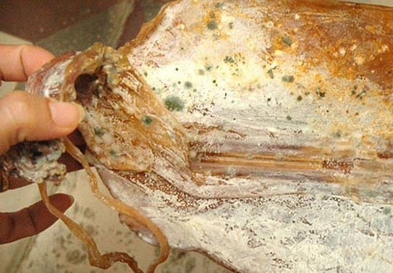 Người ta nói bệnh từ miệng mà ra, ung thư cũng vậy, nếu bạn thường xuyên ăn những thực phẩm trên thì việc ung thư tìm đến là điều không khó hiểu. Vì lợi ích của sức khỏe, mọi người nên có chế độ ăn uống lành mạnh. Ngoài ra, cũng nên đến bệnh viện khám sức khỏe định kỳ, để kịp thời phát hiện những vấn đề tiềm ẩn, ngăn ngừa ung thư.