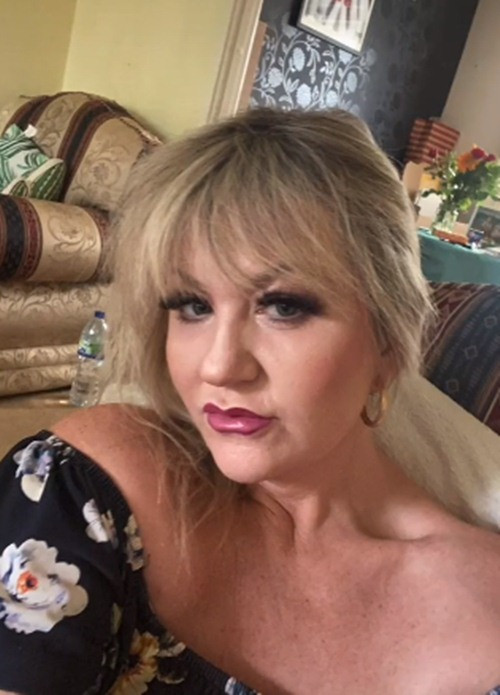 Amanda rất hài lòng với hiệu quả mang lại, nhưng cũng kêu gọi những người khác hiểu rõ về tình trạng về da của mình và hãy suy nghĩ thật kỹ trước khi đưa ra quyết định.