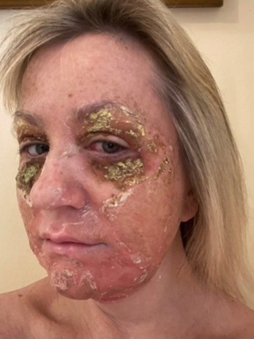 Rất muốn bỏ cuộc nhưng niềm tin "muốn đẹp thì phải đau" cùng với sự an ủi của bác sĩ khiến Amanda cố gắng chịu đựng ngày này qua ngày khác.