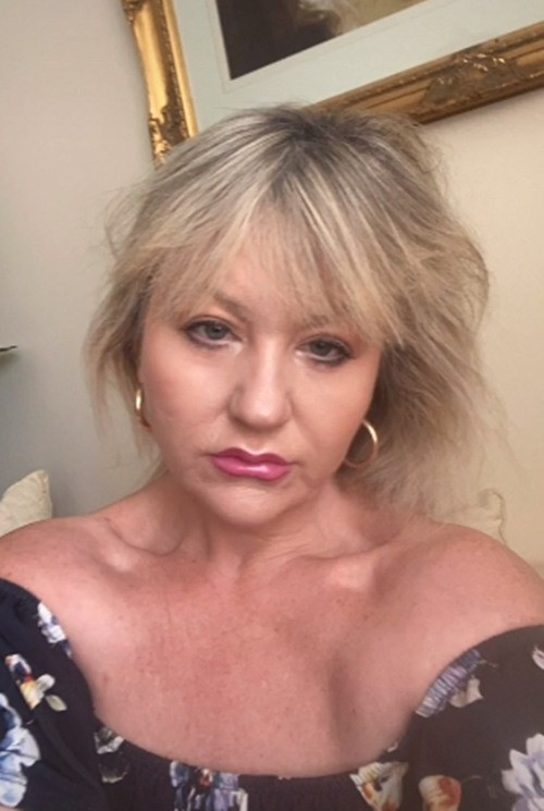 Hiện tại đôi mắt của Amanda đã hết sưng, không còn rõ nếp nhăn và gương mặt trở nên rạng rỡ hơn.