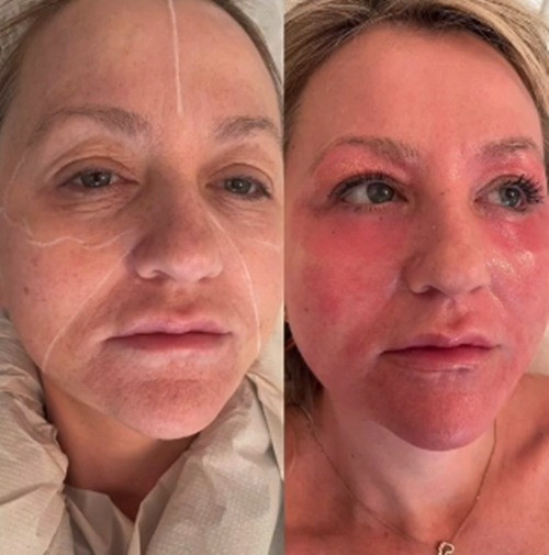 Tuy vậy có thể thấy rõ ràng, da của Amanda đã mỏng hơn rất nhiều.