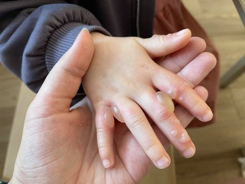 Dao choi hai hoa ngoai duong, be gai khoc thet vi bong rat-Hinh-3