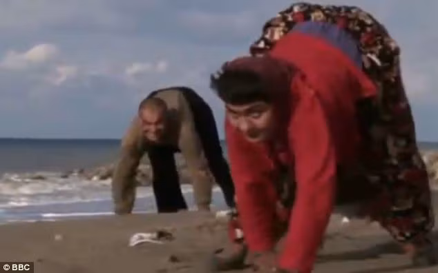 Chứng bệnh này từng được xem là chứng "tiến hóa ngược", dùng để chỉ những sự quay trở lại các đặc điểm sinh lý của tổ tiên loài người đã biến mất.