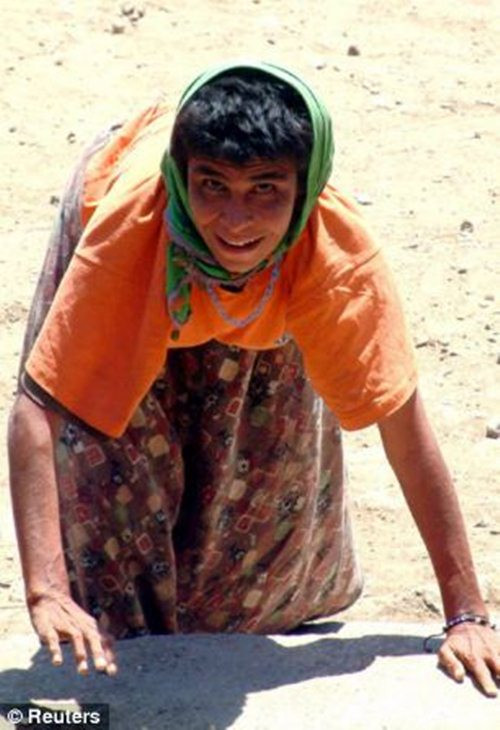 Kết quả, cả gia đình phải di chuyển bằng cả tứ chi, dựa vào cả chân và tay để bò, khiến khớp cổ tay nổi lên những vết chai dày, chẳng khác gì gót chân của người bình thường.