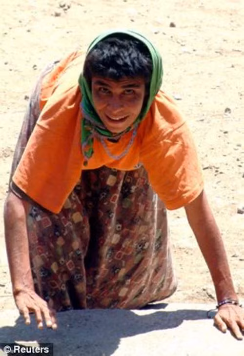 Kết quả, cả gia đình phải di chuyển bằng cả tứ chi, dựa vào cả chân và tay để bò, khiến khớp cổ tay nổi lên những vết chai dày, chẳng khác gì gót chân của người bình thường.