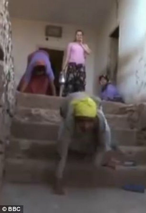 Thế nhưng gia đình người Iraq không phải là trường hợp mắc bệnh này đầu tiên trên thế giới. Từ năm 2005, 5 anh chị em ở tỉnh Hatay, phía Nam Thổ Nhĩ Kỳ đã làm đau đầu các nhà khoa học khắp thế giới với chứng bệnh lạ này.