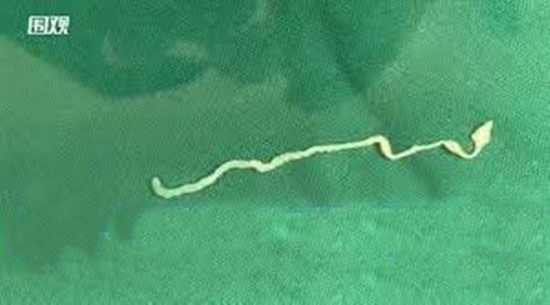 Co giat khong ro nguyen nhan, di kham bac si phat hien chuyen ghe ron