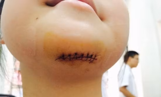 BigC Thang Long nhan trach nhiem vu be gai gap nan-Hinh-2