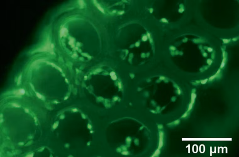 Công nghệ in 3D được phát minh vào những năm 80 của thế kỉ 20 sử dụng các tia lade để in các vật thể bằng kim loại hoặc chất dẻo theo thiết kế số hóa có độ chính xác cực cao.