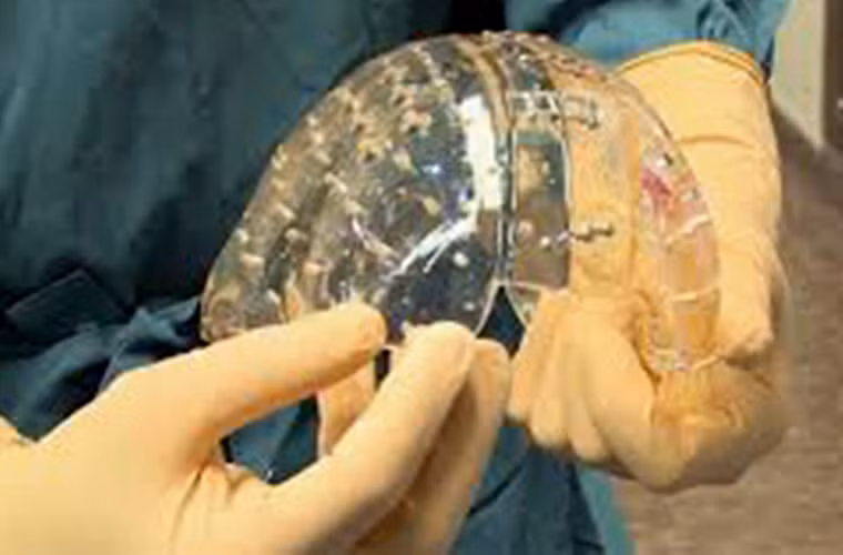 Trong tương lai, ngoài việc sản xuất động cơ máy bay, có thể ứng dụng công nghệ này cho các ngành khác như chế tạo kim loại, lĩnh vực y sinh học và tạo các bộ phận cơ thể người.