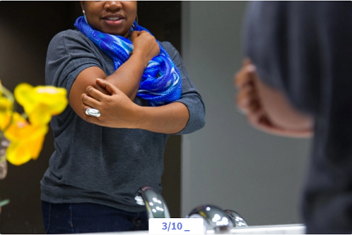  Da khô và ngứa: Suy thận khiến độc tố không được thải ra ngoài, tích tụ trong máu gây phát ban hoặc ngứa khắp người. Suy thận nặng, thận không thể cân bằng các khoáng chất và dinh dưỡng. Điều này có thể dẫn đến các bệnh về khoáng chất và xương, khiến da ngày càng trở nên khô, ngứa.