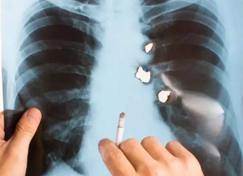 Khói thuốc lá. Khói thuốc lá chứa hơn 7.000 hóa chất. Trong số đó có hơn 100 chất có hại và 69 chất gây ung thư. Hít lượng lớn khói thuốc lá trong thời gian dài chắc chắn làm suy yếu khả năng phòng vệ của phổi, tăng nguy cơ viêm nhiễm và ung thư tế bào.