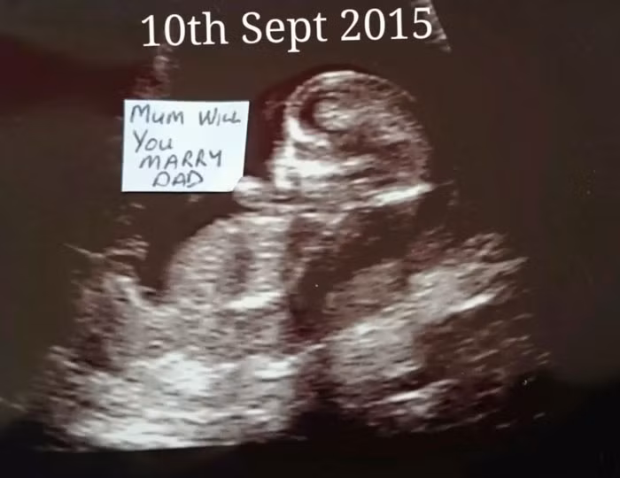 Ngay cả trong bức ảnh chụp thai nhi, chàng trai này cũng không quên gửi bạn gái lời cầu hôn ngộ nghĩnh " mẹ sẽ cưới bố chứ".