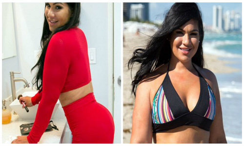 Bo tien tan phau thuat mong de giong Kim sieu vong ba-Hinh-10