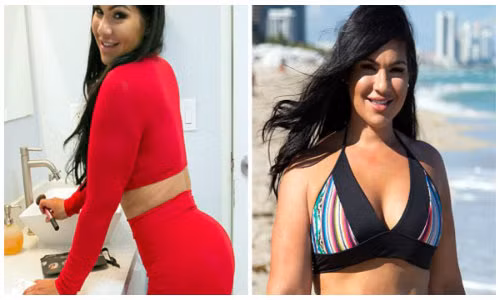 Bo tien tan phau thuat mong de giong Kim sieu vong ba-Hinh-10