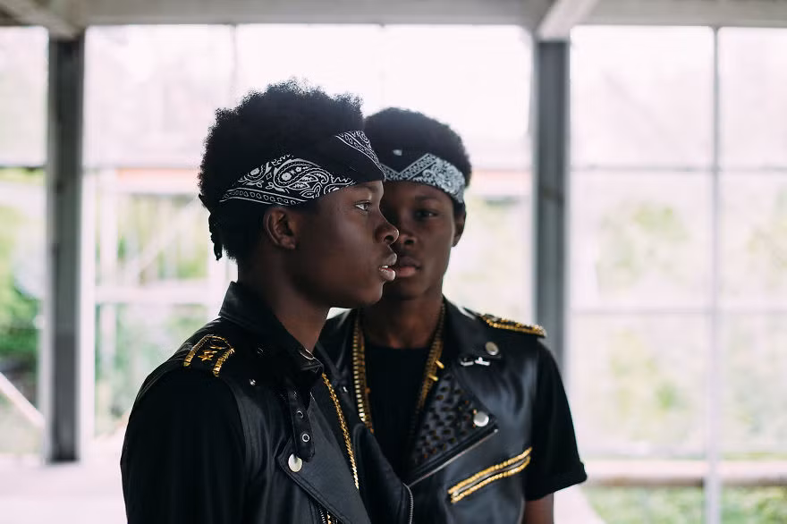 Nhung cap song sinh dep “mien che” tren the gioi