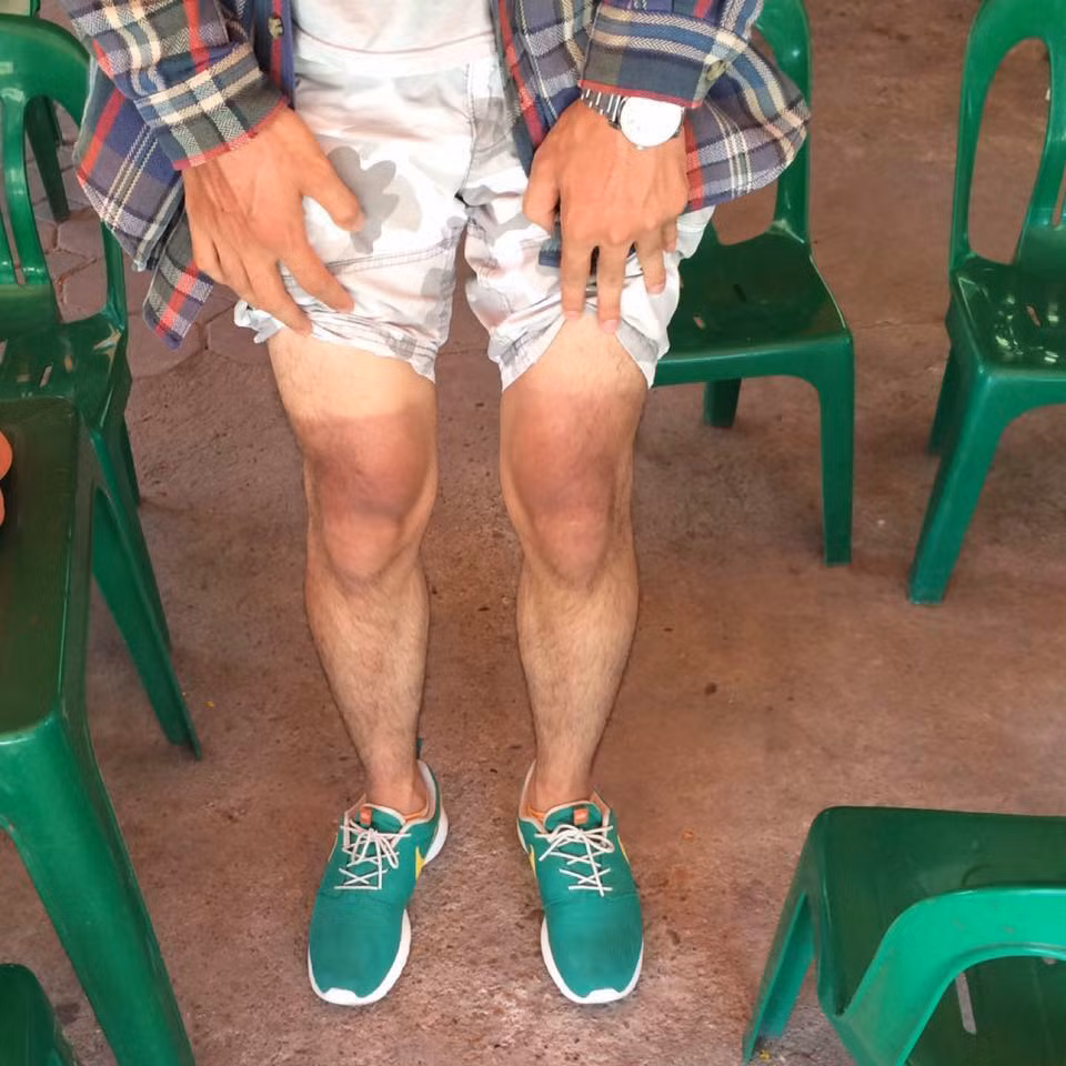 Một bức ảnh cho thấy hậu quả "khét lẹt" do nắng nóng ở Hà Nội gây ra.