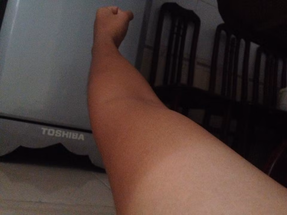 Cái nắng gay gắt và sức nhiệt có thể làm chín trứng... cũng biến những làn da trắng trẻo trở nên đen cháy, cảm giác bỏng rát. Nếu ai đó không muốn chịu cảnh "cháy đen toàn thân", chỉ che chắn một vài vùng trên cơ thể thì hậu quả sẽ là làn da vằn vện, chỗ trắng, chỗ đen sạm rất khó coi.