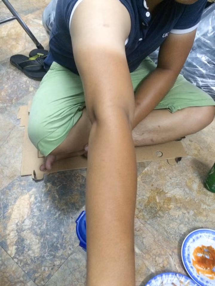 Một số trang mạng nổi tiếng đã tổng hợp lại nhiều bức ảnh khoe làn da cháy nắng của các bạn trẻ để nói về mức độ "thiệt hại" nặng nề mà thời tiết nắng nóng gây ra. "Chỗ nào không che là cháy chỗ ấy" là các mô tả của nhiều bạn trẻ về việc phải đi ra đường vào thời điểm buổi trưa, khi mặt trời chiếu rọi gay gắt.