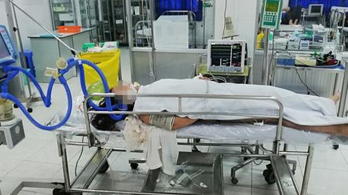 Suc khoe nu du khach bi set danh khi tam bien dang nguy kich